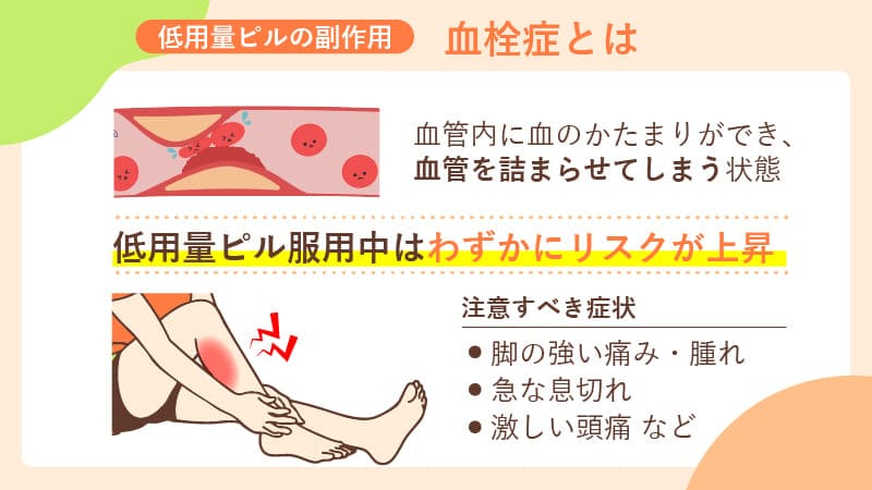 低用量ピルと血栓症リスク