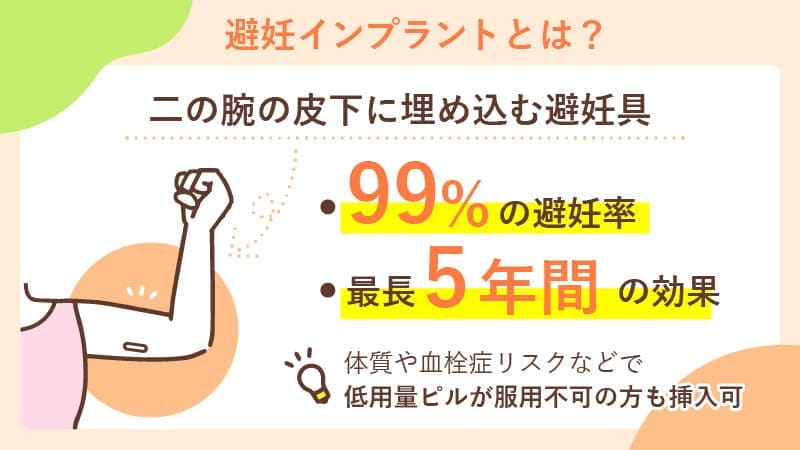 避妊インプラントとは